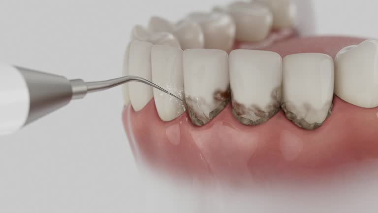 Reliable Dental Implants contractor in East End, AR by Smile Center Dentistry